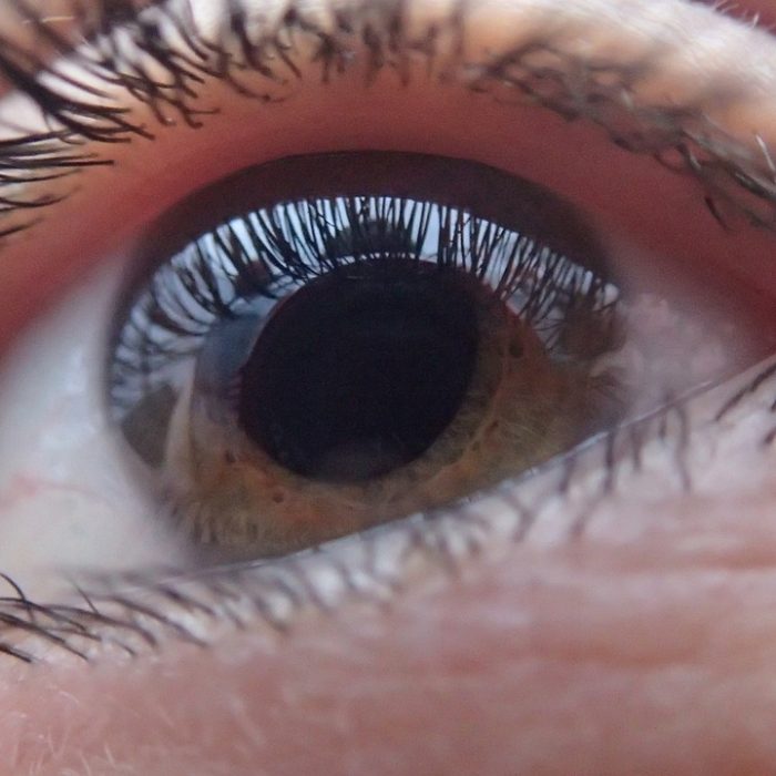 Revisar la vista a menudo evita la ceguera por glaucoma